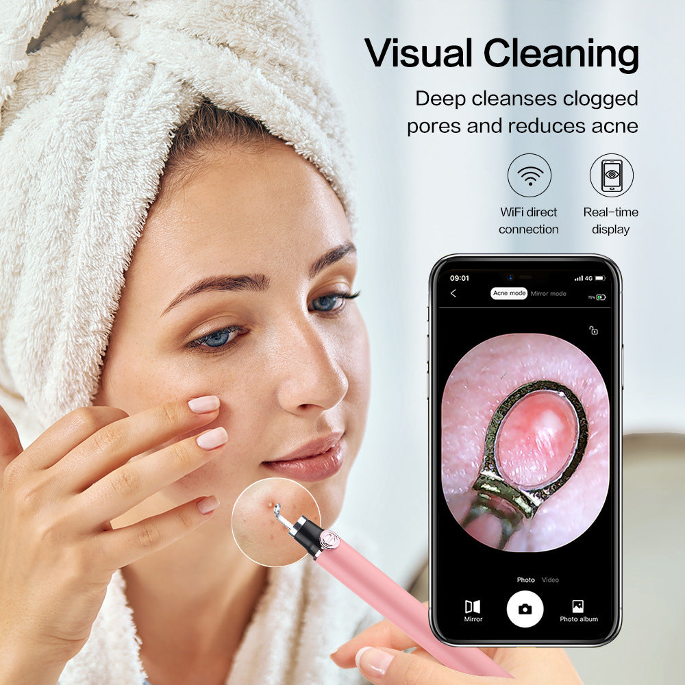 Visible Blackhead Remover with HD Camera